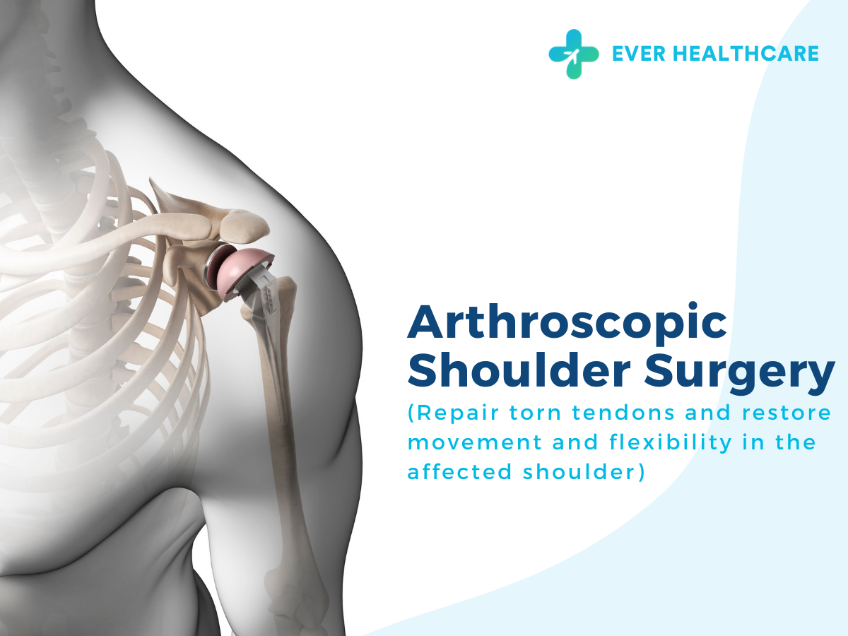 Arthroscopic Shoulder Surgery in Thailand 2023 Compare Price & Reviews Ever Healthcare